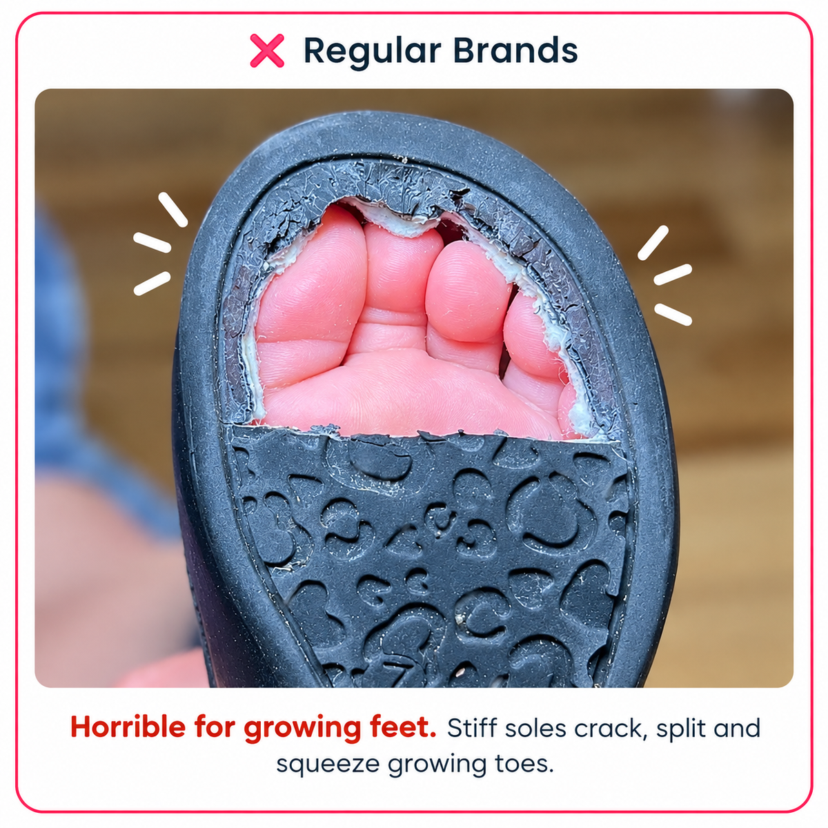 Skinomo™ Sock Shoes